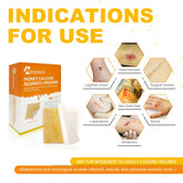 HoffenCare® Honey Calcium Alginate Wound Dressing